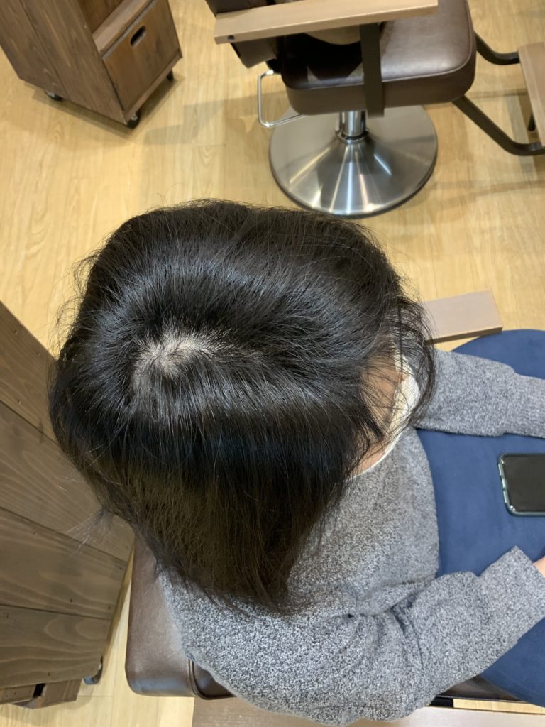 え？こんなに髪って増えるの？嘘じゃない！この発毛効果、市販育毛アイテムでレシピを再現します。 あしたきれいになあれ♪あなたとシャンプーのマッチングサイト